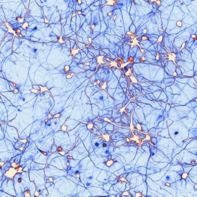 Dr Anggono’s winning entry shows neurons extending their axons to establish synaptic connections.